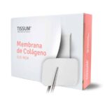Membrana Reabsorbible 1.5 x 2.0 cm Tissum